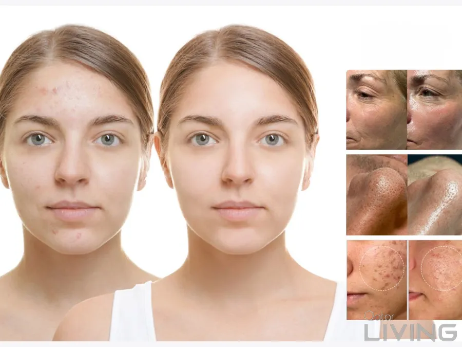 50% Off - Platinum Hydrafacial